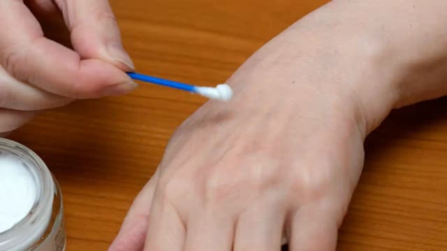 От массажного салона до стройки: в Европе снова фиксируется  проказа