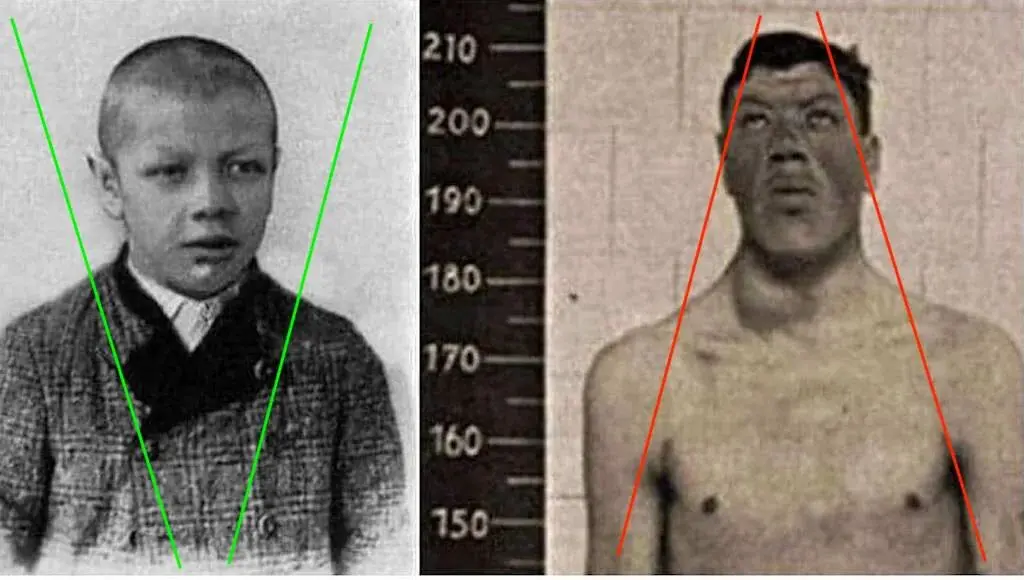 Австриец, который в своей жизни был и карликом, и гигантом